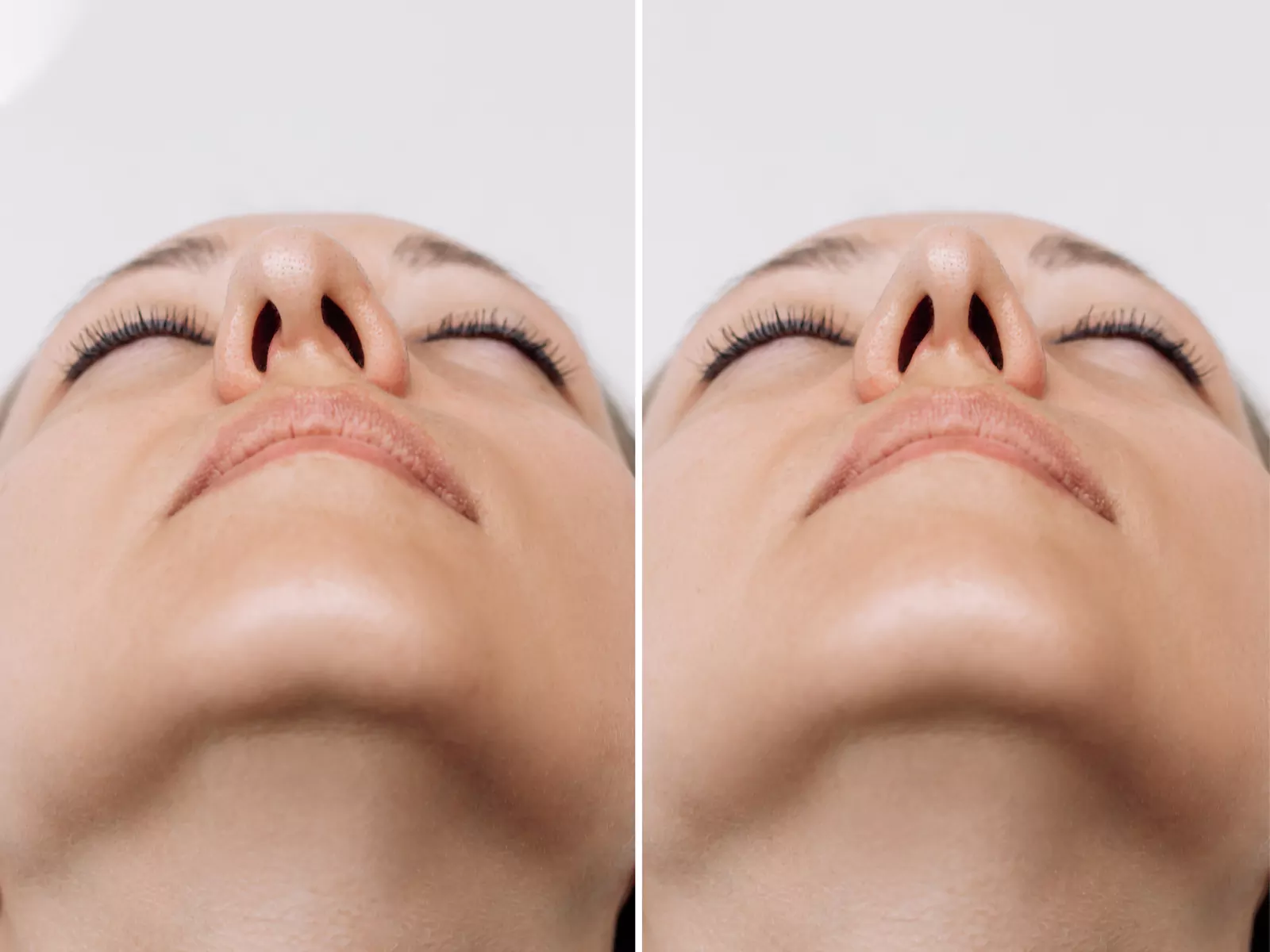 رابطه خروپف و انحراف بینی