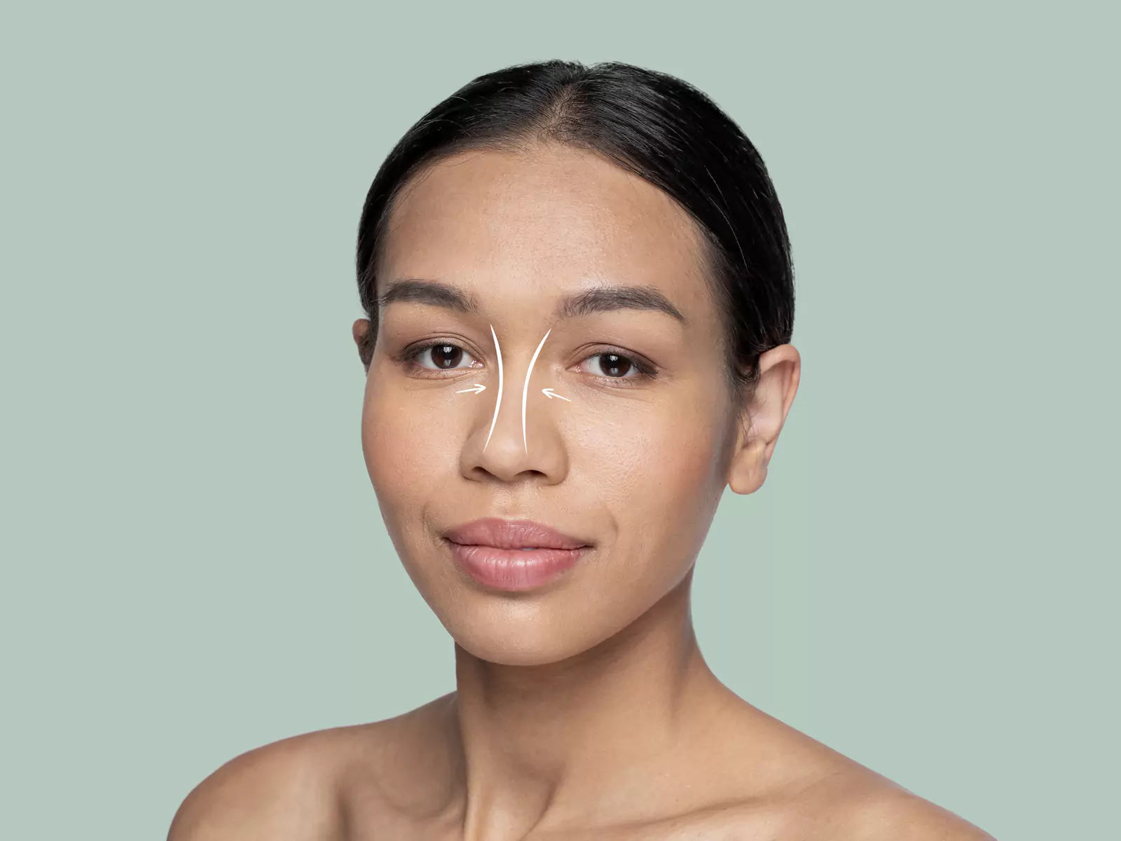 تنگی مجرای بینی