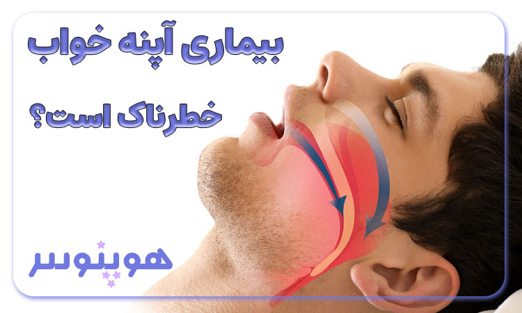 آیا بیماری آپنه خواب خطرناک است؟