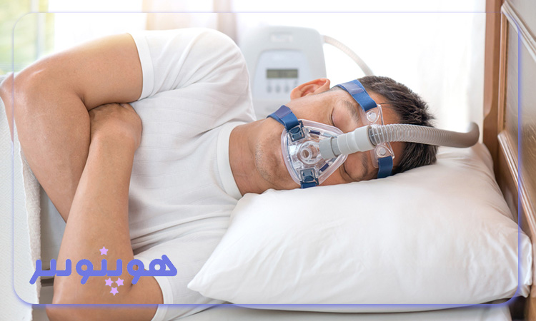 چه مدت زمانی برای بهبود عملکرد تنفسی آپنه خواب نیاز است؟